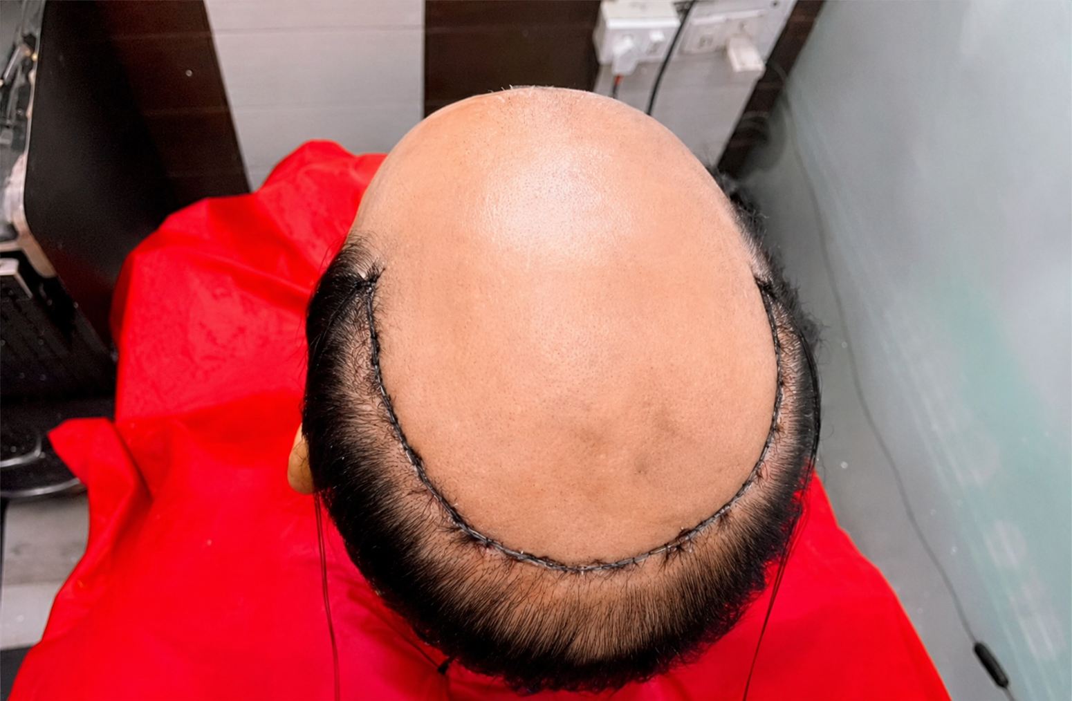 Hair Bonding Service